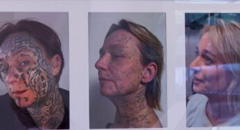 Mulher holandesa inicia remoção de 250 tatuagens impostas por ex-parceiro abusivo
