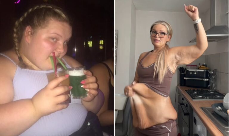 Antes e depois de Laura — Foto: Instagram/@laurabudreviciene_