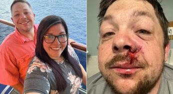 Homem do Alabama é atingido por raio no aniversário da filha, um ano após ferimento por fogos