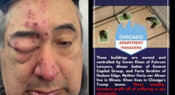 Morador de Chicago relata ataque de ratos enquanto dormia em apartamento infestado