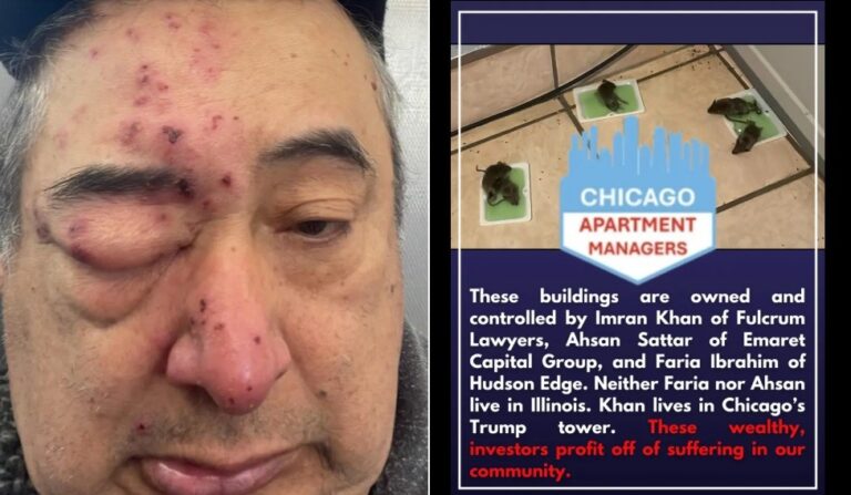 Heriverto Hernandez acordou no meio da noite em Chicago com ratos roendo o seu rosto; associação denunciou 'descaso' da administradora de prédio — Foto: Reprodução