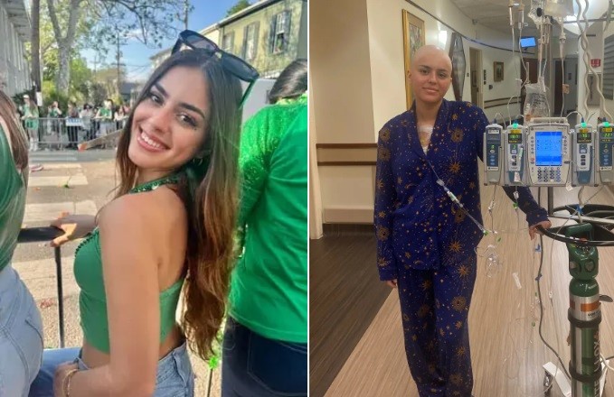Lily Dalton antes e depois de desenvolver câncer raro — Foto: Reprodução/GoFundMe