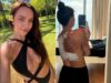 Influenciadora russa tem 30% do corpo queimado ap&oacute;s explos&atilde;o de power bank em sua cama