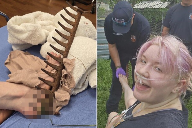 Mary Doyon acabou com pé cravado em ancinho enferrujado ao caminhar descalça pelo jardim de casa com o filho — Foto: Reprodução/TikTok