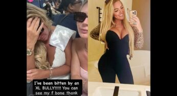 Ex-BBB britânica é mordida por cão e vira alvo de ameaças após postagem sobre raça do animal