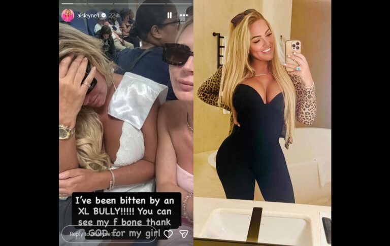 Ex-Big Brother desabafou nas redes sociais sobre o ataque — Foto: Reprodução/Instagram