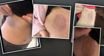 Adolescente do Arizona é indiciado por agressão após ataque com bolas de queimada em aula