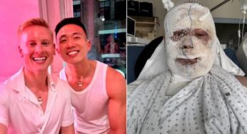 Empresário australiano sofre ataque com água fervente em hotel de luxo na França