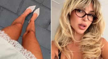 Elisabeth Rioux responde a comentários negativos após pelos em suas pernas viralizarem na internet