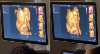 Bebê no útero sorri em ultrassom ao ouvir a voz do pai no Canadá e vídeo viraliza