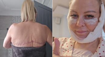 Influenciadora britânica se submete a série de cirurgias plásticas e se autodenomina ‘noiva do Frankenstein’