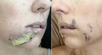 Mãe usa chinelo para afastar coiote e proteger filha de ataque no Arizona