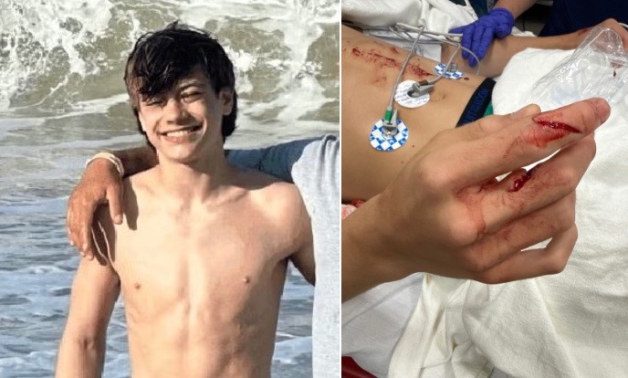 Adolescente Dominick Cebula foi atacado por castor com raiva quando nadava em lago em parque natural nos EUA — Foto: Reprodução/GoFundMe