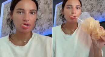 Estresse noturno: Influencer britânica acorda com lábio desfigurado após morder a si mesma dormindo