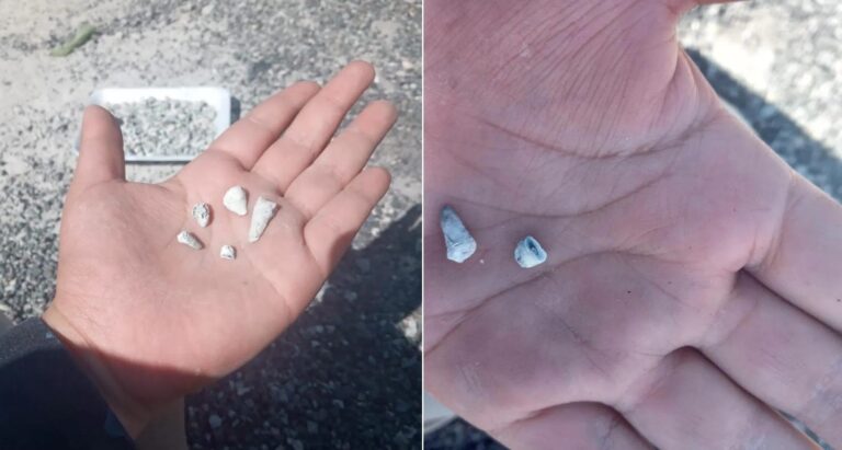 Dentes de criança achados em vala comum em fazenda no México, de acordo com grupo de buscas por desaparecidos — Foto: Reprodução/Facebook