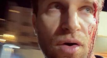 Keegan Allen sofre assalto brutal por relógio de luxo em West Hollywood